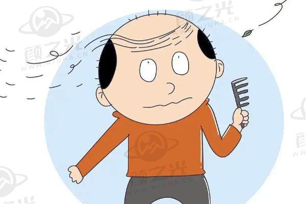2025国内植发排名前5医院深度揭秘：成都恒美等哪家更适合你？ 