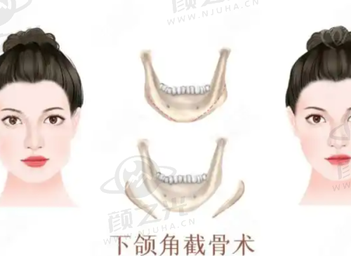 石家庄美莱整形医院排名与口碑