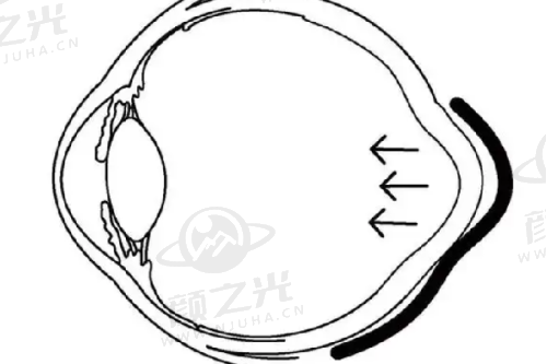 五、长沙美莱医疗美容医院网友分享项目价格