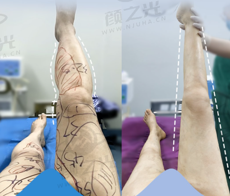 海南三亚瑞希医疗美容门诊部正规吗?资质、医生、环境等多方面揭秘!