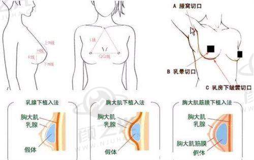 六、北京米扬丽格医疗美容门诊部有啥优惠活动？