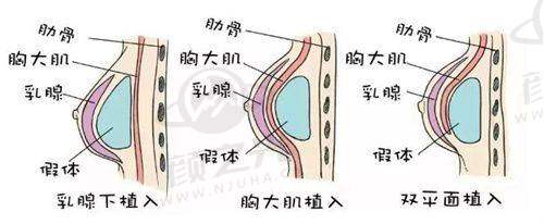 四川华西医院整容科预约全攻略：方式、放号时间、就诊流程及医生推荐大揭秘！ 