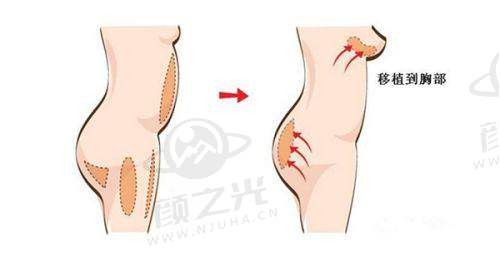 南京排名靠前的三甲整形医院大盘点！含专家介绍及常见整形项目参考价格 
