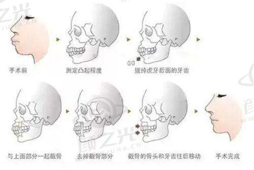 北京冰新丽格整形