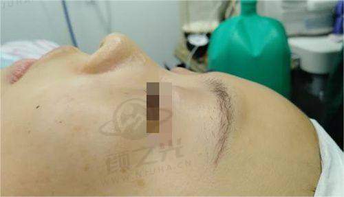 五、广州紫馨医疗美容医院值得去吗？