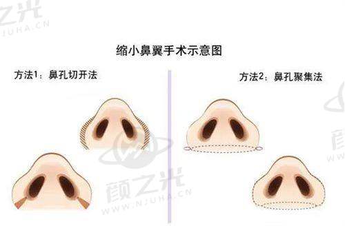 二、昆山玥美医疗美容门诊的优质环境与贴心服务