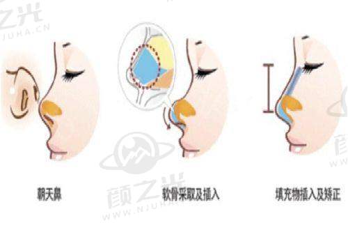 云南昆明韩辰医疗美容医院