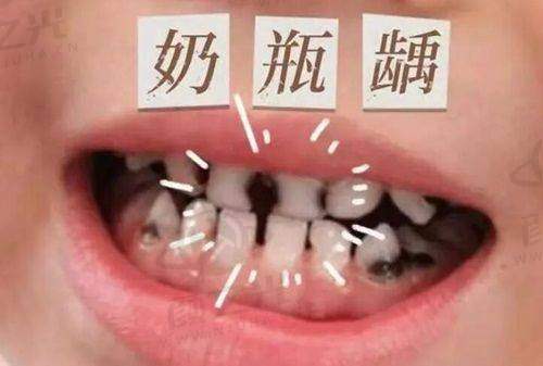 浙江宁波江北外滩好牙引领口腔诊所非凡医疗团队