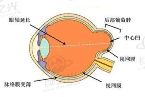 阜阳泽明眼视光眼科医院