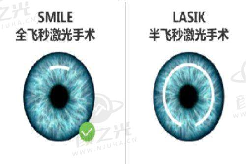 乐山爱尔眼科医院特色项目与价格