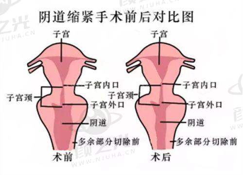 五、北京米扬丽格医疗美容门诊部的荣誉与口碑如何？