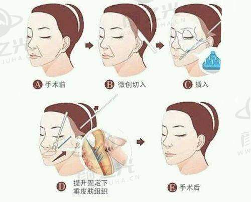 二、上海爱尚丽格：眼部修复实力担当