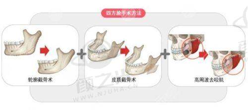 北京冰新丽格整形：医疗团队优势