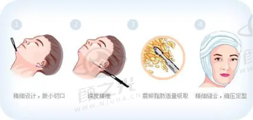 三、北京冰新丽格的实力水平