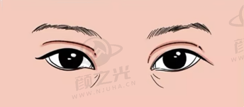盐城市艾美莉整形美容医院怎么样？三级甲等资质，隆胸隆鼻等项目超靠谱！ 