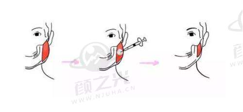 广州紫馨医疗美容医院非凡医生团队