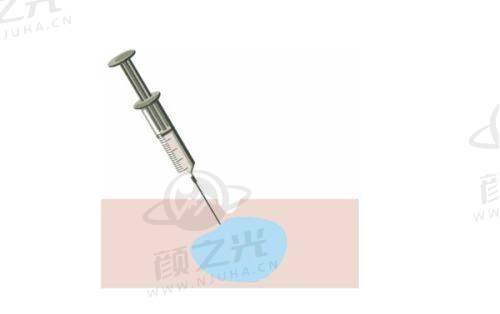 江西上饶韩美整形正规吗？审批、团队、口碑全优，多项优势揭秘！ 