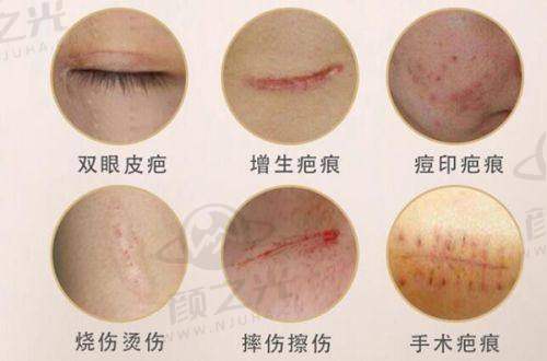 三、杭州艺星医院医生对比