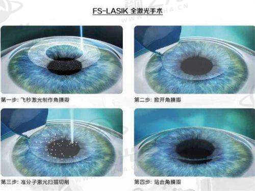四川达州睛阅眼科