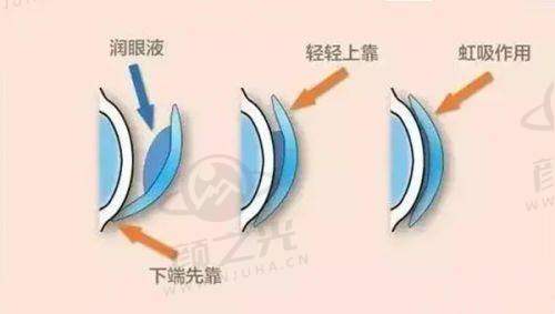 广东雷诺眼科