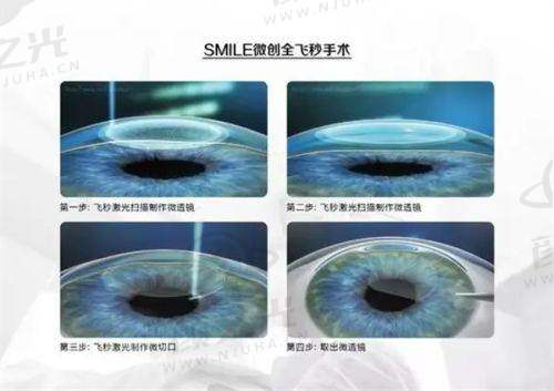 普瑞眼科是莆田系或骗局？正规资质、透明收费与患者好评揭开其真实面纱！ 