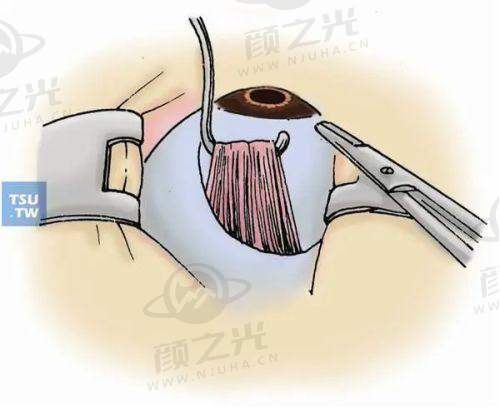 霞浦县明心眼科