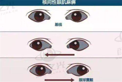 湛江爱尔眼科医院合理的价格体系