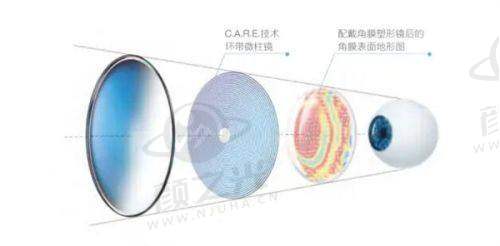 二、西安四院眼科价格详情