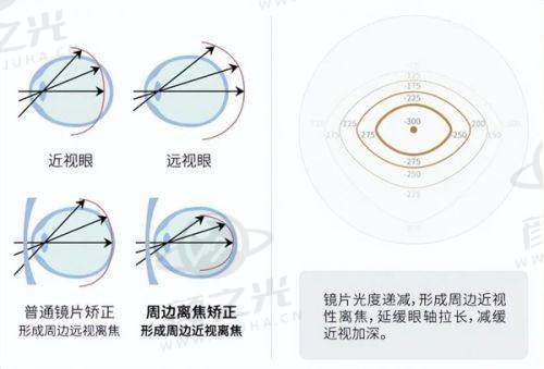 广东河源光明眼科医院的合作与科室