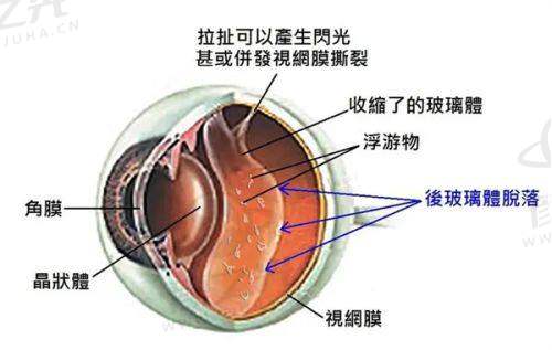 阜阳泽明眼视光眼科医院特色项目