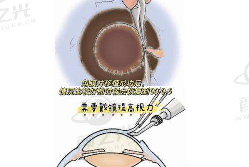 广州英华儿童眼科门诊部医疗技术与项目