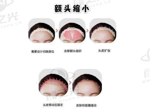 北京艺美医疗美容诊所服务与口碑