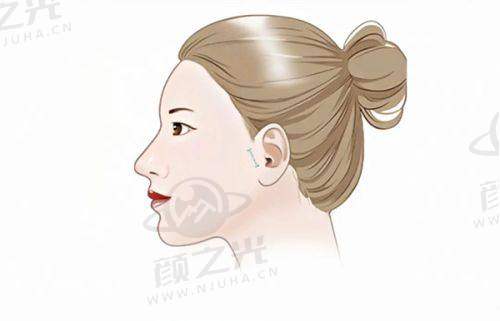 广州紫馨医疗美容医院正规吗?资质全技术优,冯传波医生隆胸超靠谱!