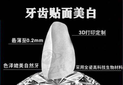 上海排名靠前的私立儿童口腔医院大揭秘！圣贝、恒愿等优势与地址全知晓！ 