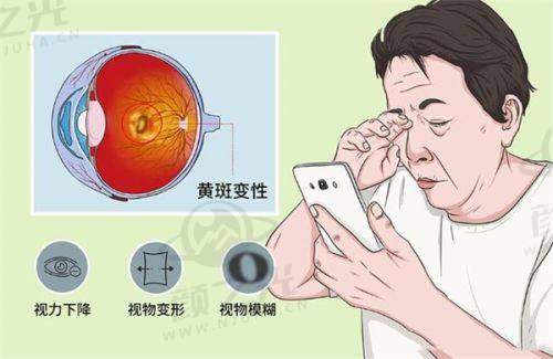 六、北京华德眼科医院：助力患者重见清晰海内外