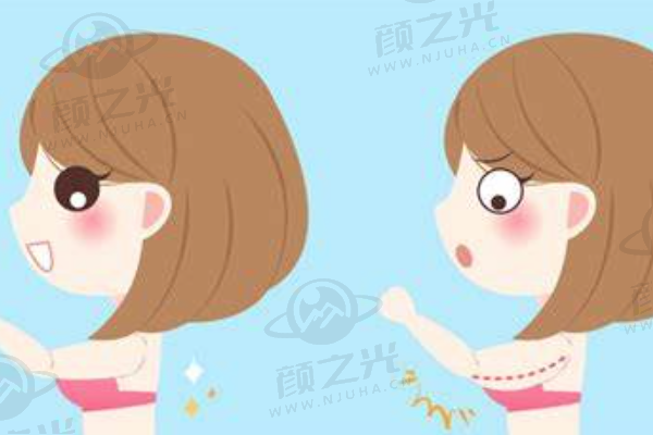 丁昆琨医生拉皮手术怎么样？花3万多值吗？10年经验医生，深扒价格与真人实例！