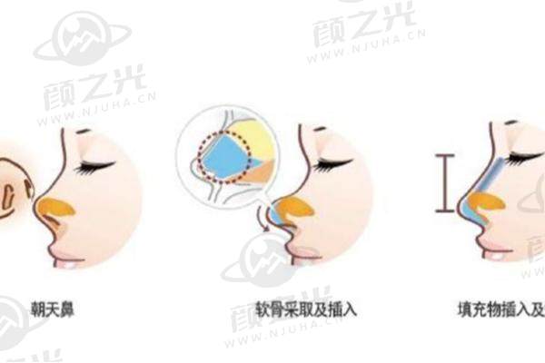 上海明星常去的整形医院大揭秘!伊莱美、薇琳等排名靠前医院特色全知晓!