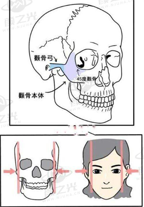 五、重庆新铜雀台整形 - 孔令杰医生吸脂成功实例众多
