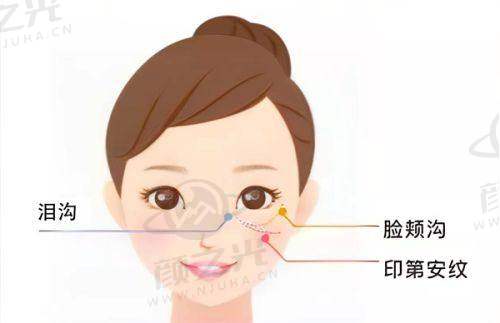 六、楚雄中医院彩光祛痘科普知识