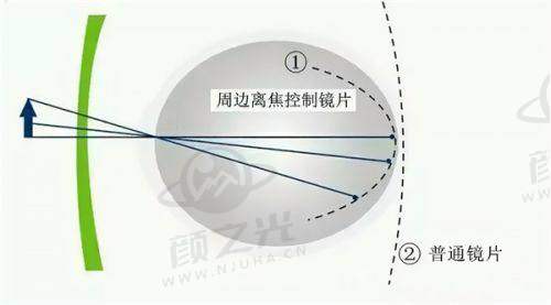 昭通艾维眼科医院全揭秘：诊疗项目、医生团队、近视手术及预约方式大公开！ 