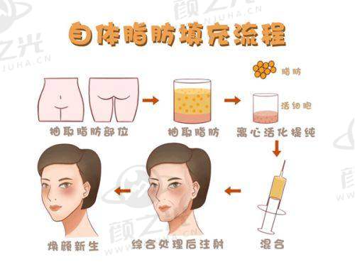 广州祛疤成效好的排名靠前医院大揭秘！含各院优势及推荐医生，疤友速看 