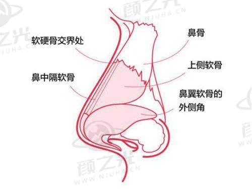 二、法欧曼玻尿酸总体概述