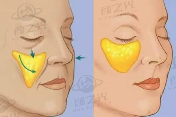 上海伊莱美整形医院靠谱吗？特色项目、专业医生、合理价格全揭秘！