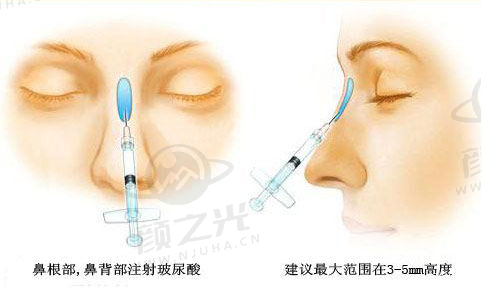 广州晨曦医疗整形美容医院：科室全医生强，优惠多服务好，助您实现美丽梦想！ 
