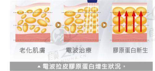 六、杭州维多利亚唐红伟整形理念