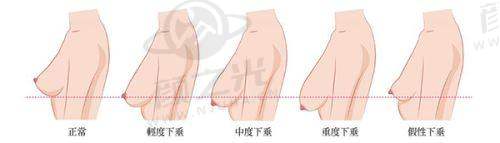 王亮亮技术优势