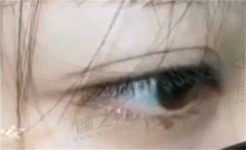 大连爱德丽格医疗美容项目价格