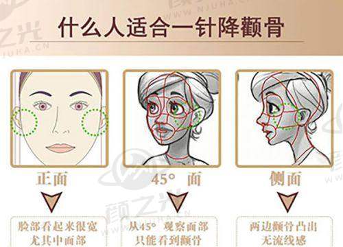 赵亮祥技术优势