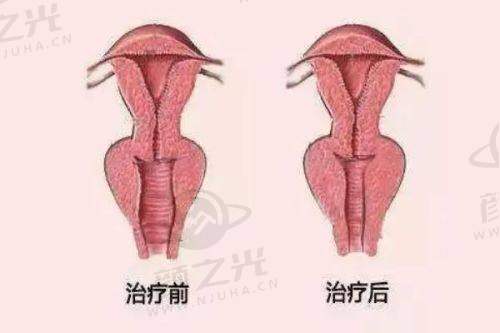 一、邯郸丽人整形正规吗？