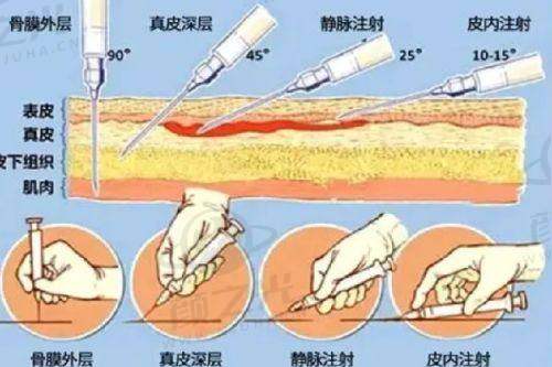 五、深圳地区整形美容项目价格参考